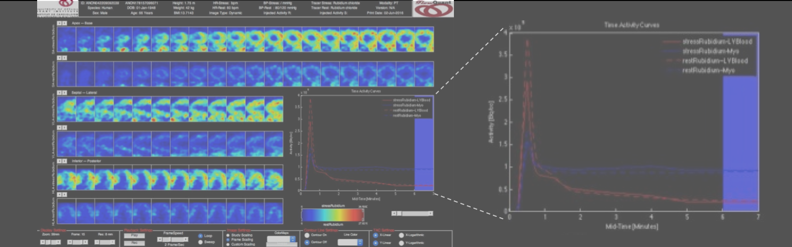 Carousel Bootstrap Third